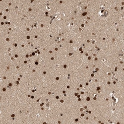Invitrogen CPSF2 Polyclonal Antibody 100 &mu;L; Unconjugated:Antibodies,