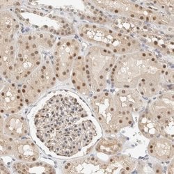 Invitrogen TSTD2 Polyclonal Antibody 100 &mu;L; Unconjugated:Antibodies,