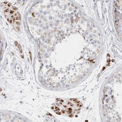 Invitrogen FAM71F2 Polyclonal Antibody 100 &mu;L; Unconjugated:Antibodies,