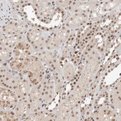 Invitrogen TNRC18 Polyclonal Antibody 100 &mu;L; Unconjugated:Antibodies,