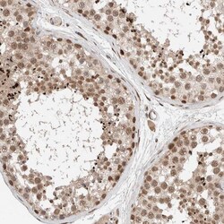 Invitrogen TNRC18 Polyclonal Antibody 100 &mu;L; Unconjugated:Antibodies,