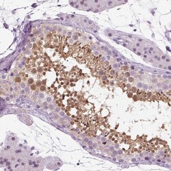Invitrogen SPATA31E1 Polyclonal Antibody 100 &mu;L; Unconjugated:Antibodies,