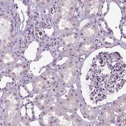 Invitrogen SPATA31E1 Polyclonal Antibody 100 &mu;L; Unconjugated:Antibodies,
