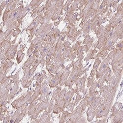 Invitrogen POPDC2 Polyclonal Antibody 100 &mu;L; Unconjugated:Antibodies,