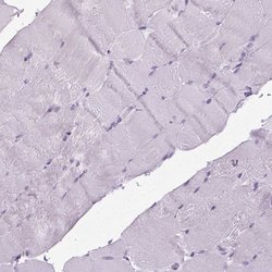 Invitrogen POPDC2 Polyclonal Antibody 100 &mu;L; Unconjugated:Antibodies,