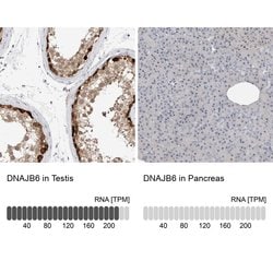 Invitrogen DNAJB6 Polyclonal Antibody 100 &mu;L; Unconjugated:Antibodies,