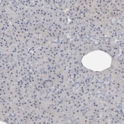 Invitrogen DNAJB6 Polyclonal Antibody 100 &mu;L; Unconjugated:Antibodies,