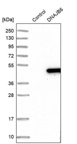 Invitrogen DNAJB6 Polyclonal Antibody 100 &mu;L; Unconjugated:Antibodies,