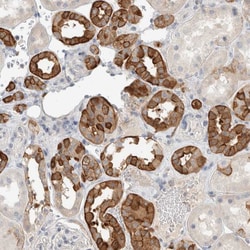 Invitrogen SCIN Polyclonal Antibody 100 &mu;L; Unconjugated:Antibodies,