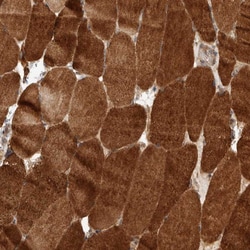 Invitrogen PRDM15 Polyclonal Antibody 100 &mu;L; Unconjugated:Antibodies,