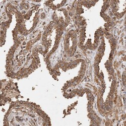 Invitrogen SNX31 Polyclonal Antibody 100 &mu;L; Unconjugated:Antibodies,