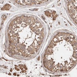 Invitrogen SNX31 Polyclonal Antibody 100 &mu;L; Unconjugated:Antibodies,