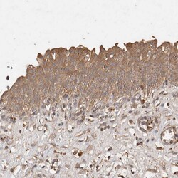 Invitrogen SNX31 Polyclonal Antibody 100 &mu;L; Unconjugated:Antibodies,