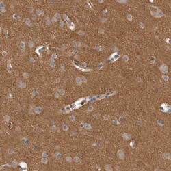 Invitrogen Dematin Polyclonal Antibody 100 &mu;L; Unconjugated:Antibodies,