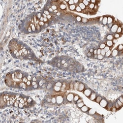 Invitrogen Adenylate Cyclase 8 Polyclonal Antibody 100 &mu;L; Unconjugated:Antibodies,