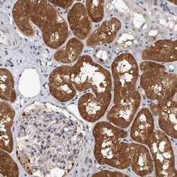 Invitrogen FBXO43 Polyclonal Antibody 100 &mu;L; Unconjugated:Antibodies,