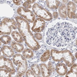 Invitrogen B3GNT3 Polyclonal Antibody 100 &mu;L; Unconjugated:Antibodies,