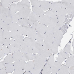 Invitrogen B3GNT3 Polyclonal Antibody 100 &mu;L; Unconjugated:Antibodies,