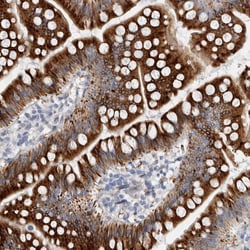 Invitrogen B3GNT3 Polyclonal Antibody 100 &mu;L; Unconjugated:Antibodies,