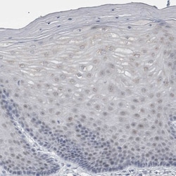 Invitrogen Perilipin 1 Polyclonal Antibody 100 &mu;L; Unconjugated:Antibodies,