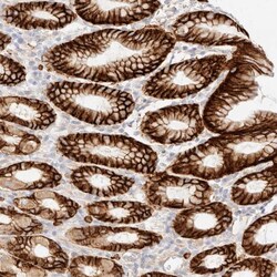 Invitrogen Niban-like protein Polyclonal Antibody 100 &mu;L; Unconjugated:Anticuerpos