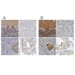 Invitrogen GDAP1 Polyclonal Antibody 100 &mu;L; Unconjugated:Antibodies,