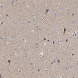 Invitrogen GDAP1 Polyclonal Antibody 100 &mu;L; Unconjugated:Antibodies,