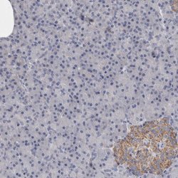 Invitrogen GDAP1 Polyclonal Antibody 100 &mu;L; Unconjugated:Antibodies,