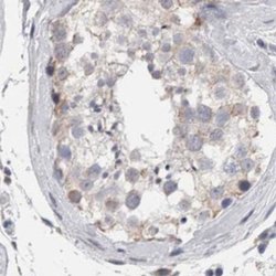 Invitrogen GDAP1 Polyclonal Antibody 100 &mu;L; Unconjugated:Antibodies,
