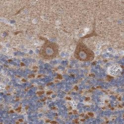 Invitrogen GDAP1 Polyclonal Antibody 100 &mu;L; Unconjugated:Antibodies,