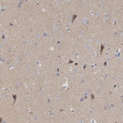 Invitrogen GDAP1 Polyclonal Antibody 100 &mu;L; Unconjugated:Antibodies,
