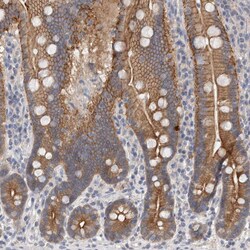 Invitrogen OTOR Polyclonal Antibody 100 &mu;L | Buy Online | Invitrogen&trade; | Fisher Scientific