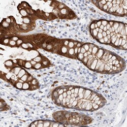 Invitrogen NAPE PLD Polyclonal Antibody 100 &mu;L; Unconjugated:Antibodies,