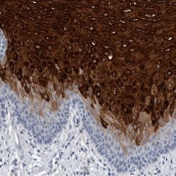 Invitrogen CRNN Polyclonal Antibody 100 &mu;L; Unconjugated:Antibodies,