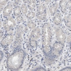 Invitrogen CRNN Polyclonal Antibody 100 &mu;L; Unconjugated:Antibodies,