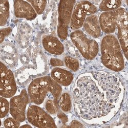 Invitrogen CARKL Polyclonal Antibody 100 &mu;L; Unconjugated:Antibodies,
