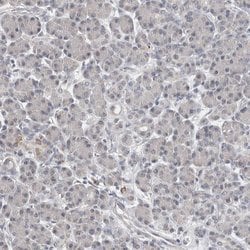 Invitrogen CARKL Polyclonal Antibody 100 &mu;L; Unconjugated:Antibodies,