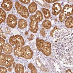 Invitrogen SNAPC5 Polyclonal Antibody 100 &mu;L; Unconjugated:Antibodies,