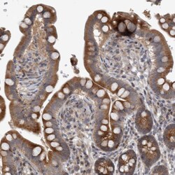Invitrogen ERAL1 Polyclonal Antibody 100 &mu;L; Unconjugated:Antibodies,