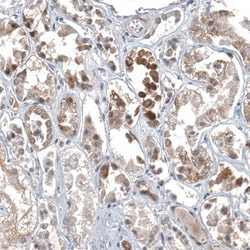 Invitrogen C1orf112 Polyclonal Antibody 100 &mu;L; Unconjugated:Antibodies,
