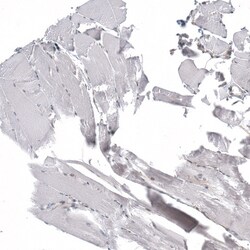 Invitrogen C1orf112 Polyclonal Antibody 100 &mu;L; Unconjugated:Antibodies,
