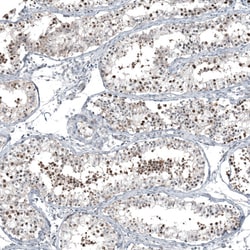 Invitrogen C1orf112 Polyclonal Antibody 100 &mu;L; Unconjugated:Antibodies,