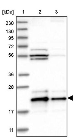 Invitrogen C17orf49 Polyclonal Antibody 100 &mu;L | Buy Online | Invitrogen&trade; | Fisher Scientific