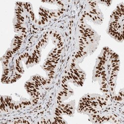 Invitrogen C17orf49 Polyclonal Antibody 100 &mu;L | Buy Online | Invitrogen&trade; | Fisher Scientific
