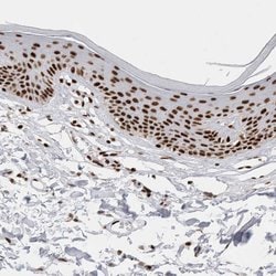 Invitrogen C17orf49 Polyclonal Antibody 100 &mu;L | Buy Online | Invitrogen&trade; | Fisher Scientific