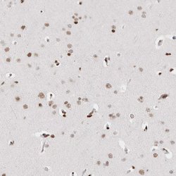 Invitrogen C17orf49 Polyclonal Antibody 100 &mu;L | Buy Online | Invitrogen&trade; | Fisher Scientific