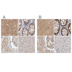 Invitrogen WIPF2 Polyclonal Antibody 100 &mu;L; Unconjugated:Antibodies,
