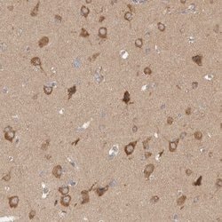 Invitrogen WIPF2 Polyclonal Antibody 100 &mu;L; Unconjugated:Antibodies,
