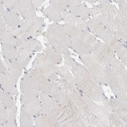 Invitrogen WIPF2 Polyclonal Antibody 100 &mu;L; Unconjugated:Antibodies,