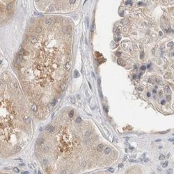 Invitrogen WIPF2 Polyclonal Antibody 100 &mu;L; Unconjugated:Antibodies,